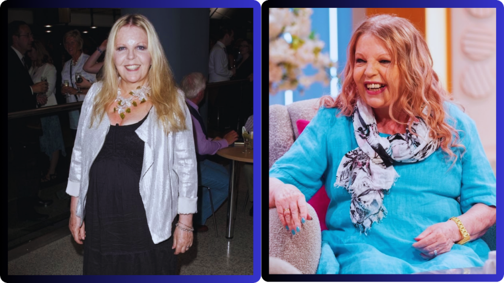sally thomsett face illness